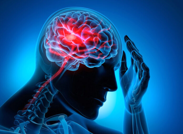Man with brain stroke symptoms